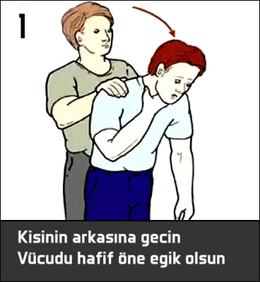 Heimlich manevrası nasıl yapılır ?