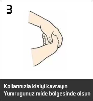 Heimlich manevrası yapılışı