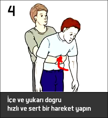 Heimlich manevrasının yapılışı resimli anlatım