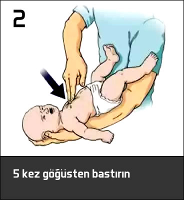 bebek boğuluyorsa ilk yardım