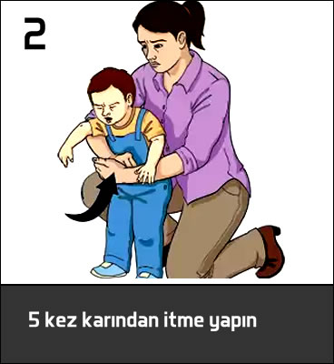 boğulan çocuğa ilk yardım heimlich manevrası
