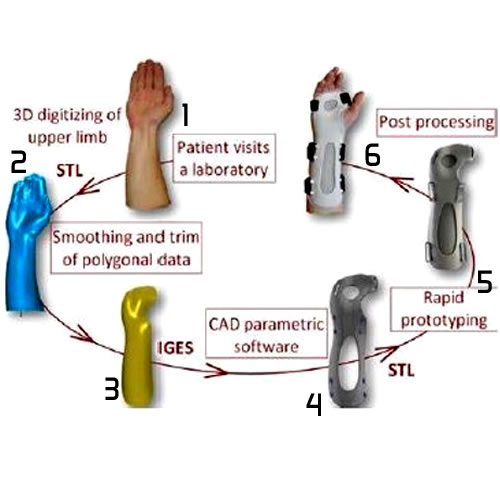 prosthesis 3d scanning - printing process
