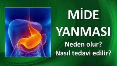 MİDE YANMASI NEDEN OLUR? NASIL TEDAVİ EDİLİR?